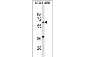 Western blot analysis in NCI-H460 cell line lysates (35ug/lane). (PET112L anticorps  (N-Term))