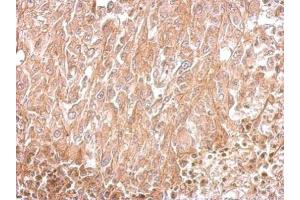IHC-P Image Amphiphysin antibody [N1N2], N-term detects AMPH protein at cytosol on RT2 xenograft by immunohistochemical analysis. (Amphiphysin anticorps  (N-Term))