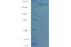 SDS-PAGE (SDS) image for UDP-N-Acetyl-alpha-D-Galactosamine:polypeptide N-Acetylgalactosaminyltransferase 14 (GalNAc-T14) (GALNT14) (AA 1-552), (full length) protein (His-SUMO Tag) (ABIN5711557)