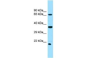 WB Suggested Anti-SLC13A1 Antibody Titration: 1.