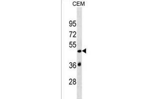 SP140L Antibody (Center) (ABIN1537899 and ABIN2849879) western blot analysis in CEM cell line lysates (35 μg/lane). (SP140L anticorps  (AA 158-185))