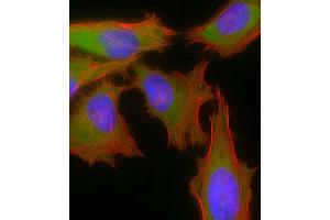 Immunofluorescent analysis of 4 % paraformaldehyde-fixed, 0.