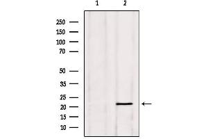 Western blot analysis of extracts from Hela, using PGRMC1 Antibody. (PGRMC1 anticorps  (C-Term))