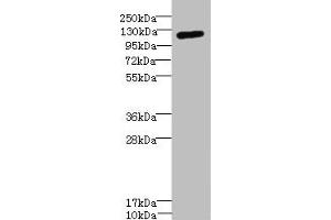 Western blot All lanes: ITGAXantibody IgG at 1.