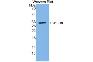 Western blot analysis of the recombinant protein. (Kallikrein 1 anticorps  (AA 21-261))