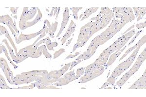 Detection of FUCa1 in Mouse Cardiac Muscle Tissue using Polyclonal Antibody to Fucosidase Alpha L1, Tissue (FUCa1) (FUCA1 anticorps  (AA 185-447))