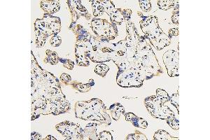 IHC analysis of IFNAR2 using anti-IFNAR2 antibody (ABIN7601353). (IFNAR2 anticorps  (AA 33-466))