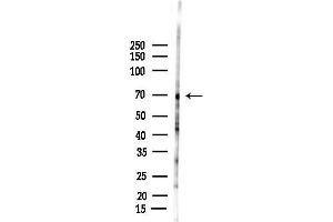 Western blot analysis of lysates from Rat testis, using AIRE Antibody at 1/1000 dilution.