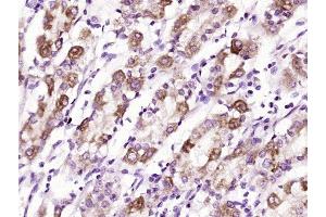 Paraformaldehyde-fixed, paraffin embedded human stomach tissue, Antigen retrieval by boiling in sodium citrate buffer (pH6.