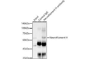 Immunoprecipitation analysis of 300 μg extracts of PC-3 cells using 3 μg Neurofilament H antibody (ABIN7268866). (NEFH anticorps)