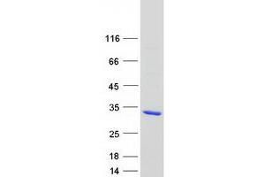 Validation with Western Blot