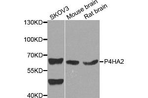 Western blot analysis of extract of various cells, using P4HA2 antibody. (P4HA2 anticorps)
