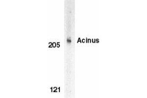 Western blot analysis of Acinus in K562 whole cell lysate with Acinus antibody at 1 μg/ml. (ACIN1 anticorps)