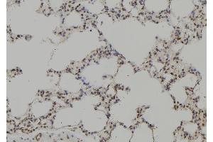 ABIN6265073 and ABIN6269204 at 1/100 staining Rat lung tissue by IHC-P. (SHP1 anticorps  (C-Term))