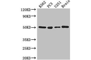 Western Blot Positive WB detected in: K562 whole cell lysate, PC-3 whole cell lysate, U251 whole cell lysate, Mouse brain tissue All lanes: TUBA1C antibody at 3 μg/mL Secondary Goat polyclonal to rabbit IgG at 1/50000 dilution Predicted band size: 50 kDa Observed band size: 50 kDa (TUBA1C anticorps  (AA 29-184))