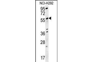STA18 Antibody (N-term) (ABIN657881 and ABIN2846836) western blot analysis in NCI- cell line lysates (15 μg/lane). (SPATA18 anticorps  (N-Term))
