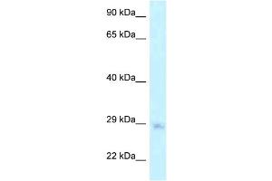 WB Suggested Anti-MTG1 Antibody Titration: 1. (MTG1 anticorps  (Middle Region))