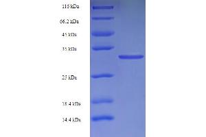 SDS-PAGE (SDS) image for Retinoic Acid Receptor Responder (Tazarotene Induced) 2 (RARRES2) (AA 21-157) protein (His-SUMO Tag) (ABIN5711723)