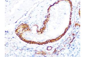 Immunohistochemistry of paraffin-embedded rat ovary using LDHB Rabbit mAb (ABIN7268170) at dilution of 1:100 (40x lens). (LDHB anticorps)