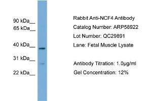 WB Suggested Anti-NCF4  Antibody Titration: 0. (NCF4 anticorps  (C-Term))