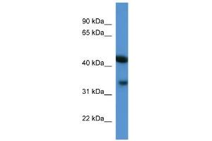 WB Suggested Anti-Centa1 Antibody Titration: 0. (ADAP1 anticorps  (C-Term))