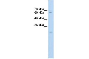 WB Suggested Anti-CES2 Antibody Titration:  0. (CES2 anticorps  (C-Term))