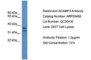 WB Suggested Anti-SCAMP3  Antibody Titration: 0. (SCAMP3 anticorps  (N-Term))