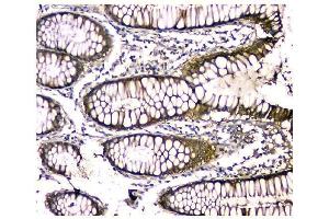 IHC analysis of CA2 using anti-CA2 antibody (ABIN6719533). (CA2 anticorps  (AA 2-260))