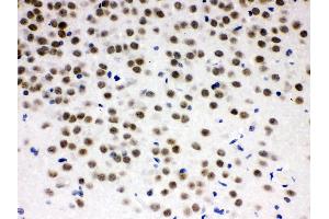 anti-Zinc Finger and BTB Domain Containing 7A (ZBTB7A) (AA 125-163), (N-Term) antibody