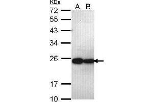 WB Image Sample (30 ug of whole cell lysate) A: A431 , B: H1299 12% SDS PAGE antibody diluted at 1:1000