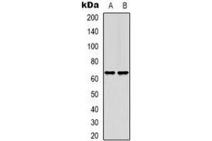 Western blot analysis of TIGD1 expression in HEK293T (A), Hela (B) whole cell lysates. (TIGD1 anticorps)