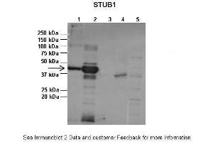 Lanes:   1:1ug insoluble STUB1 protein, 2:1ug soluble STUB1 protein, 3:1ug EPM2A protein, 4:1ug insoluble PPP1R3C protein, 5:1ug soluble PPP1R3C protein  Primary Antibody Dilution:   1:2500  Secondary Antibody:   Anti-rabbit-AP  Secondary Antibody Dilution:   1:20,000  Gene Name:   STUB1  Submitted by:   Pedro Castanheira, Biocant (STUB1 anticorps  (N-Term))