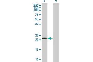 Western Blot analysis of PYCARD expression in transfected 293T cell line by PYCARD MaxPab polyclonal antibody.