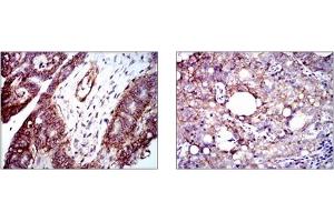 Immunohistochemistry (IHC) image for anti-Integrin beta 1 (ITGB1) antibody (ABIN1106231)