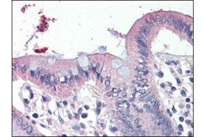 Human Colon (formalin-fixed, paraffin-embedded) stained with SCNN1Gat 4 µg/ml followed by biotinylated anti-goat IgG secondary antibody, alkaline phosphatase-streptavidin and chromogen. (SCNN1G anticorps  (C-Term))