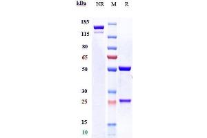 Anti-CALCRL / CGRPR Reference Antibody (erenumab) on SDS-PAGE under reducing (R) condition.