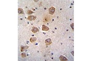 Formalin fixed, paraffin embedded human brain tissue stained with RLBP1L2 Antibody (C-term) followed by peroxidase conjugation of the secondary antibody and DAB staining.