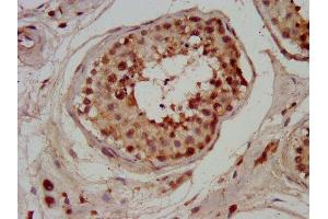 IHC image of ABIN7147514 diluted at 1:200 and staining in paraffin-embedded human testis tissue performed on a Leica BondTM system.