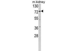 Western blot analysis of Villin-1 Antibody (N-term) in mouse kidney tissue lysates (35ug/lane). (Villin 1 anticorps  (N-Term))