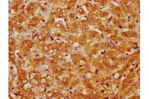 IHC image of ABIN7146870 diluted at 1:300 and staining in paraffin-embedded human liver tissue performed on a Leica BondTM system.