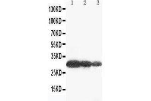 Anti-Aquaporin 6 antibody, Western blotting Lane 1: U87 Cell Lysate Lane 2: COLO320 Cell Lysate Lane 3: MCF-7 Cell Lysate (AQP6 anticorps  (C-Term))