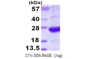 SDS-PAGE (SDS) image for alpha 1 Microglobulin/bikunin precursor (AMBP) (AA 20-203) protein (His tag) (ABIN667966)