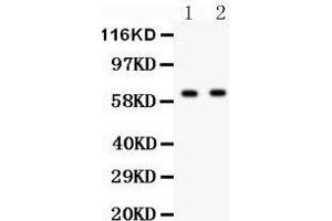Anti- HEXB antibody, Western blotting All lanes: Anti HEXB  at 0. (HEXB anticorps  (AA 381-556))