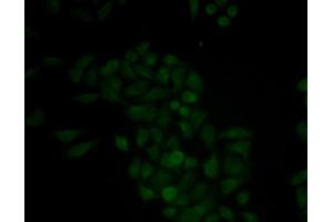 Immunofluorescence analysis of MCF-7 cell using CTSE antibody. (Cathepsin E anticorps)