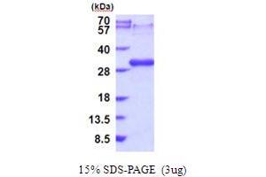 SDS-PAGE (SDS) image for Lymphotoxin beta Receptor (TNFR Superfamily, Member 3) (LTBR) (AA 28-227) protein (His tag) (ABIN5853989)