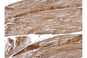 IHC-P Image Desmin antibody detects Desmin protein at cytosol on mouse skeletal muscle by immunohistochemical analysis.