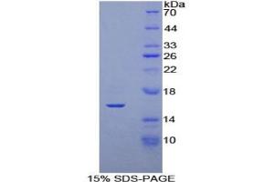 SDS-PAGE of Protein Standard from the Kit (Highly purified E.