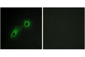 Immunofluorescence analysis of HeLa cells, using CAMK5 Antibody. (CAMKV anticorps  (AA 211-260))