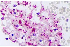Anti-PPBP antibody IHC staining of human intravascular platelets. (CXCL7 anticorps)