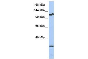 OSMR antibody used at 1 ug/ml to detect target protein. (Oncostatin M Receptor anticorps  (Middle Region))